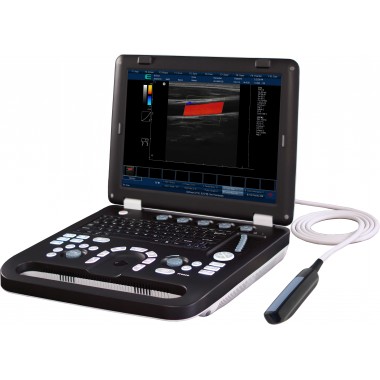 Veterinary Portable Color Doppler Ultrasound Scanner