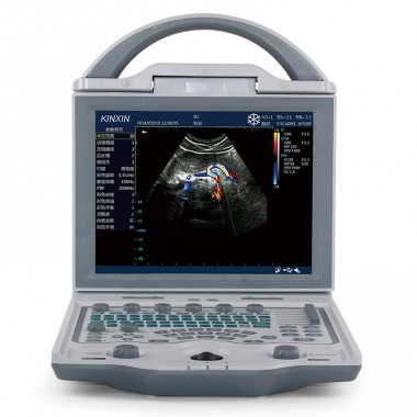 Ultrasound portable 2d doppler cheapest machine for sale linear