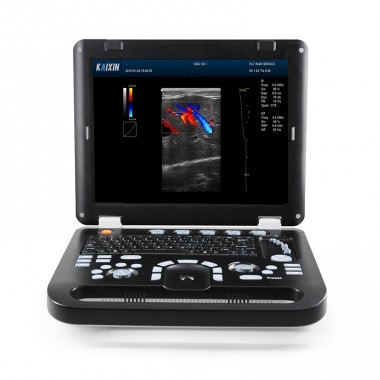 doppler color ultrasound equipment