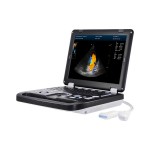 portable digital ultrasound scan machine veterinary laptop ultrasound scanner