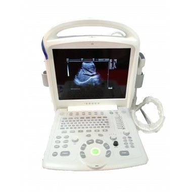 Big size screen ultrasound machine