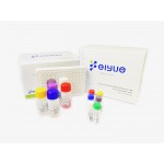 Human SERPINC1(Antithrombin-III) ELISA Kit