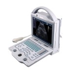 Ultrasound veterinary portable machine usb ultrasound handheld scanner