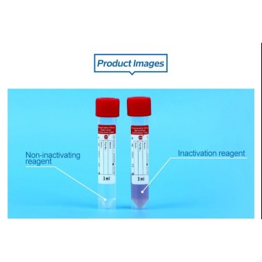 Disposable High Quality Virus Specimen Collection Tube Flocked Swabs