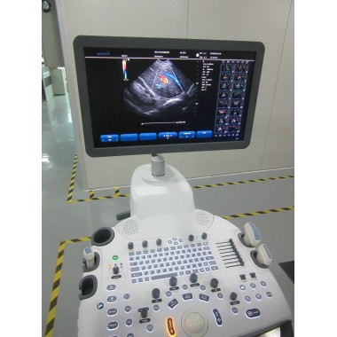 Trolly 2D Echocardiography Color Doppler Ultrasound Scanner