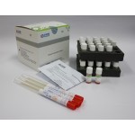 Novel Cornonvirus (COVID-19) Antigen Detection Kit