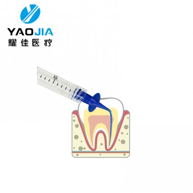 YJ1001 0.25mm Pre-bent Plastic Dental Needle Tips