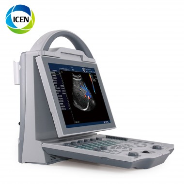 IN-A12 Portable Laptop Color Doppler  Ultrasound Scanner Diagnosis Ultrasound Machines Trolley