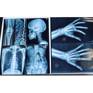 Medical thermal X-ray film