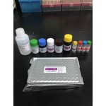 Diagnostic Elisa Kit for HIV/1+2 Antibody/Antigen (Sandwich immunoassay) Sfda Approved HIV 4th Generation