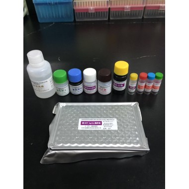 Diagnostic Elisa Kit for HIV/1+2 Antibody/Antigen (Sandwich immunoassay) Sfda Approved HIV 4th Generation