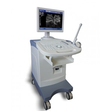 Trolly Build-in Black and White Ultrasound Scanner Diagnostic Equipment
