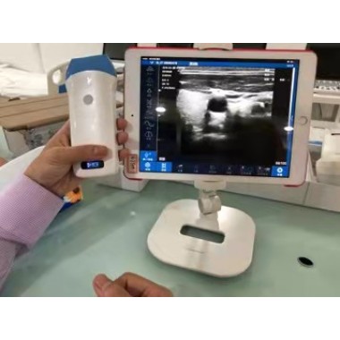 Wireless Doppler Ultrasound Diagnostic System Chinese Manufacturer GYF