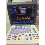 Popular Portable Color Doppler Ultrasound Scanner