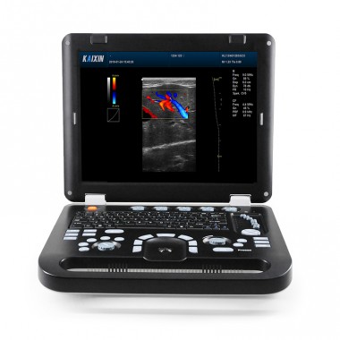 medical ultrasound instruments full digital color doppler portable human ultrasound machine
