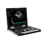 Middle and small animals 15 inches LCD portable bovine veterinary laptop ultrasound scan machine