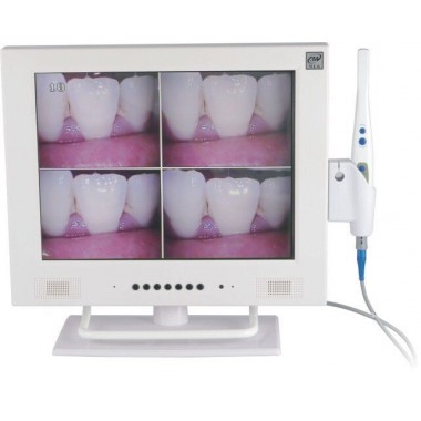 Dental Intra-Oral Camera