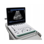 Notebook 15in led large screen ultrasound scanner