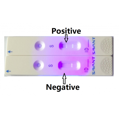 Cov 19 antigen rapid detection kit