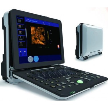Laptop Ultrasound machine Color Doppler scanner machine 3D/ 4D model C300