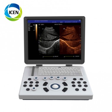 IN-A6 4D laptop portable color doppler sonography portable ultrasound machine
