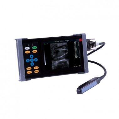 Image Rotbrown Annotation Function Handheld Veterinary Ultrasound Scanner Machine Portable Ultrasound Price Class II