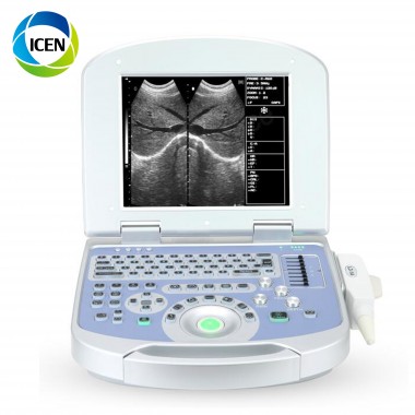 IN-A50 Digital Laptop 2D Echo Ultrasound Scanner Diagnosis Ultrasound Machine