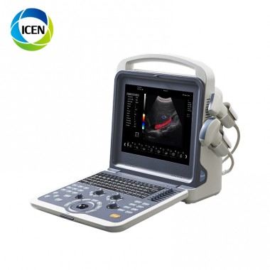 IN-AK0 Laptop Usb Probe 3D Color Doppler Transvaginal Ultrasound Machine Price