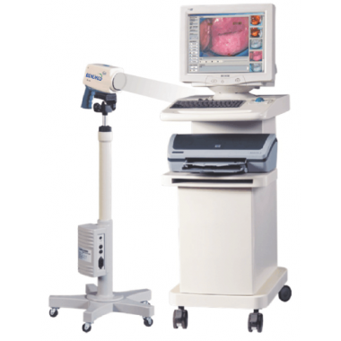 Medical Equipment Digital Video Colposcope for Gynecology