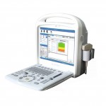 YYOKO-8000 (portable) Ultrasonic bone densitometer