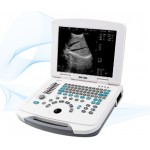 DW-500 12.1 inch LED Full-digital Laptop Ultrasound Scanner