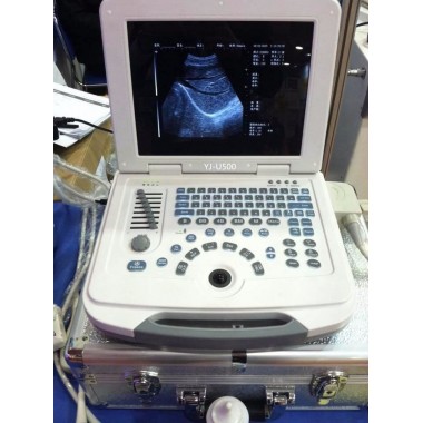 Hot Selling Full-Digital B/W Laptop Ultrasound Scanner (YJ-U580)