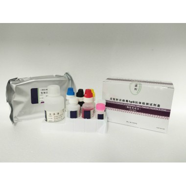 ELISA kit for detection of antibodies (IgG) against Hepatitis E Virus