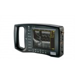 S550 Palm-held Ultrasound Scanner