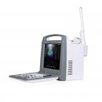 DP-6018P cheapest laptop color doppler ultrasound machine/high resolution ultrasound scanner