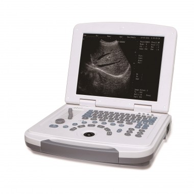 Imagine Diagnosis Full Digital B Model Ultrasound (YJ-U500)