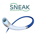 Sneak Microcatheter
