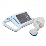 Plam mini ultrasound scanner