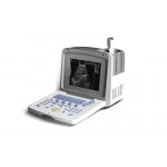 Portable Ultrasonic diagnostic apparatus