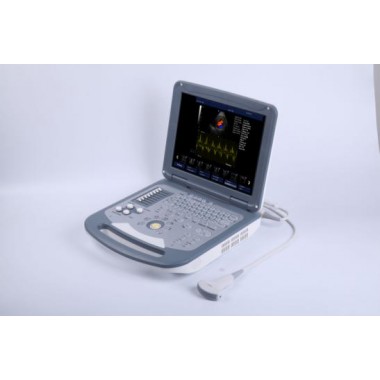 Notebook Color Doppler Portable Ultrasound Portable Diagnostic Equipment Abdomen Ultrasound
