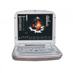 DP-6018L Cardiac Portable Color Doppler Ultrasound Machine Price Medical 3D Echocardiography Ecografo USD Echo