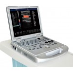 Laptop Ultrasound Color Doppler scanner diagnostic machine 3D/ 4D model DWC60 Plus