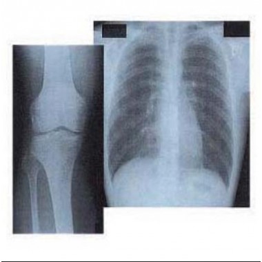 Medical X ray film Green sensitive