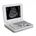 DP-3018 Hospital equipment portable Ultrasound machine with best price for Pregnancy