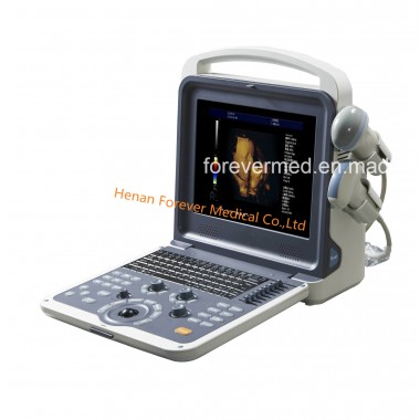 Most Advance Technology Digital Diagnostic Instrument Ultrasound System
