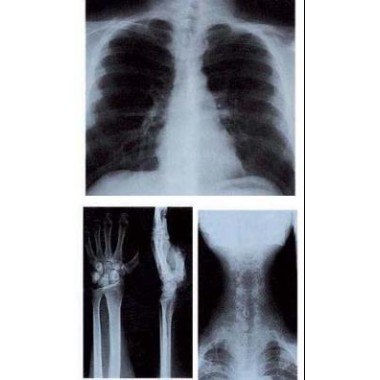 Medical x ray film  Blue Sensitive
