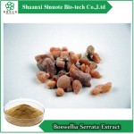 Boswellia Serrata Extract;Boswellic Acid 65%
