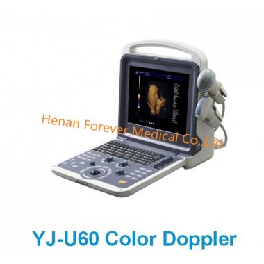 12 Inch LED Full Digital Color Doppler Diagnostic Medical Sonography
