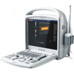 Color Doppler Ultrasound Diagnostic