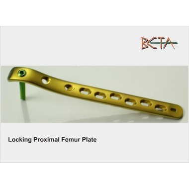 locking proximal femur plate